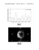 NON-INVASIVE TOOLS FOR DETECTING VULNERABLE ATHEROSCLEROTIC PLAQUES diagram and image