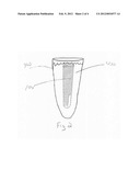 DENTAL IMPLANT WITH OSTEOINDUCTIVE CARRIER SYSTEM diagram and image