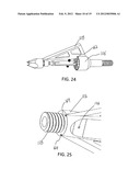 ARROWHEAD WITH LASER diagram and image