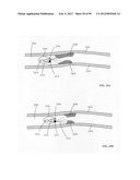 Parameter-based navigation by a lumen traveling device diagram and image