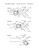 Parameter-based navigation by a lumen traveling device diagram and image