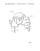 Parameter-based navigation by a lumen traveling device diagram and image