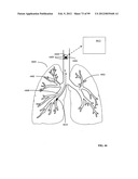 Parameter-based navigation by a lumen traveling device diagram and image