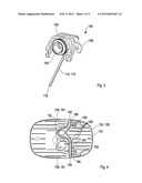 MEDICAL DEVICE WITH A COLLECTION CHANNEL FOR A BODILY FLUID diagram and image