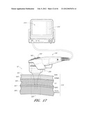 Tissue Imaging And Treatment Method diagram and image