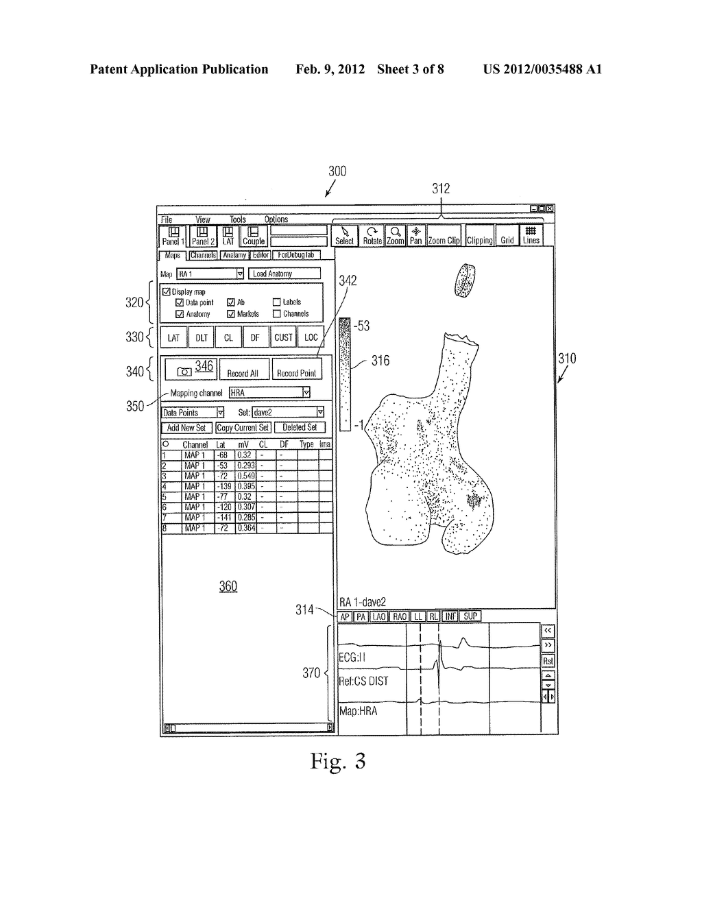 RAPID 3D MAPPING USING MULTIELECTRODE POSITION DATA - diagram, schematic, and image 04