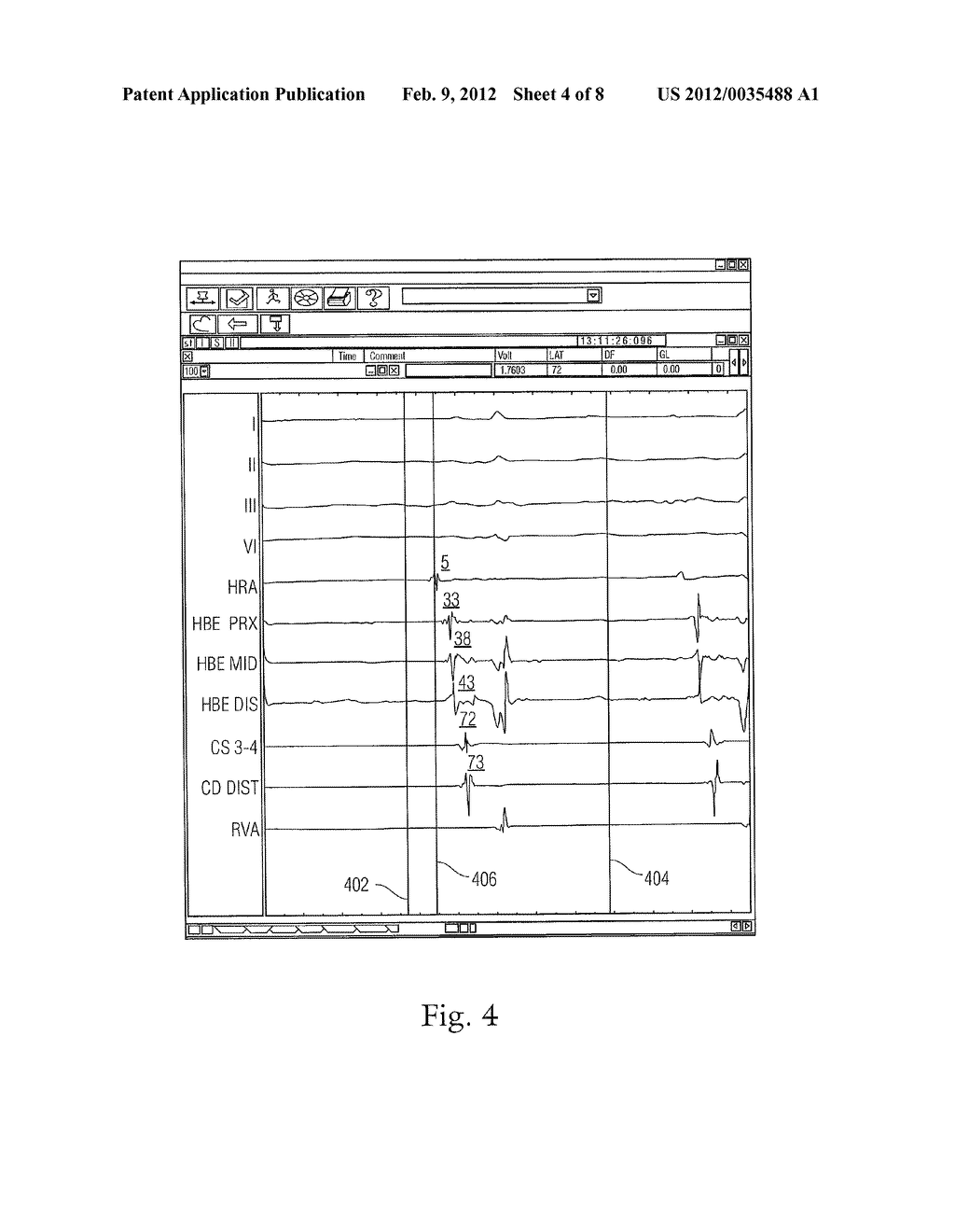 RAPID 3D MAPPING USING MULTIELECTRODE POSITION DATA - diagram, schematic, and image 05