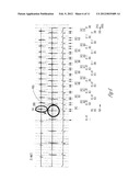 RHYTHM DISCRIMINATION ENHANCEMENT - CHAMBER OF TACHY ORIGINATION diagram and image