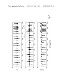 RHYTHM DISCRIMINATION ENHANCEMENT - CHAMBER OF TACHY ORIGINATION diagram and image