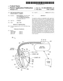 RHYTHM DISCRIMINATION ENHANCEMENT - AV DRIVE diagram and image