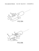 MAGNETICALLY GUIDED CATHETERS diagram and image