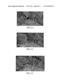 Device and Method for Abscess Irrigation diagram and image