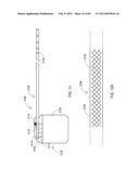 STEERING AN IMPLANTABLE MEDICAL LEAD VIA A ROTATIONAL COUPLING TO A STYLET diagram and image