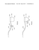 STEERING AN IMPLANTABLE MEDICAL LEAD VIA A ROTATIONAL COUPLING TO A STYLET diagram and image