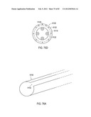 STEERING AN IMPLANTABLE MEDICAL LEAD VIA A ROTATIONAL COUPLING TO A STYLET diagram and image