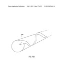 STEERING AN IMPLANTABLE MEDICAL LEAD VIA A ROTATIONAL COUPLING TO A STYLET diagram and image