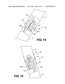 ARTICULABLE SURGICAL INSTRUMENT diagram and image