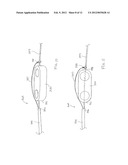 DELIVERY SYSTEM FOR MAGNETIC ANASTOMOSIS DEVICE diagram and image