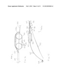 DELIVERY SYSTEM FOR MAGNETIC ANASTOMOSIS DEVICE diagram and image