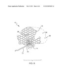 VISCEROTOMY CLOSURE DEVICE AND METHOD OF USE diagram and image