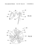 CLOSURE DEVICE WITH LONG TINES diagram and image