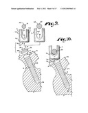 Dynamic stabilization medical implant assemblies and methods diagram and image