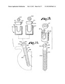 Dynamic stabilization medical implant assemblies and methods diagram and image