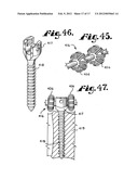 Dynamic stabilization medical implant assemblies and methods diagram and image