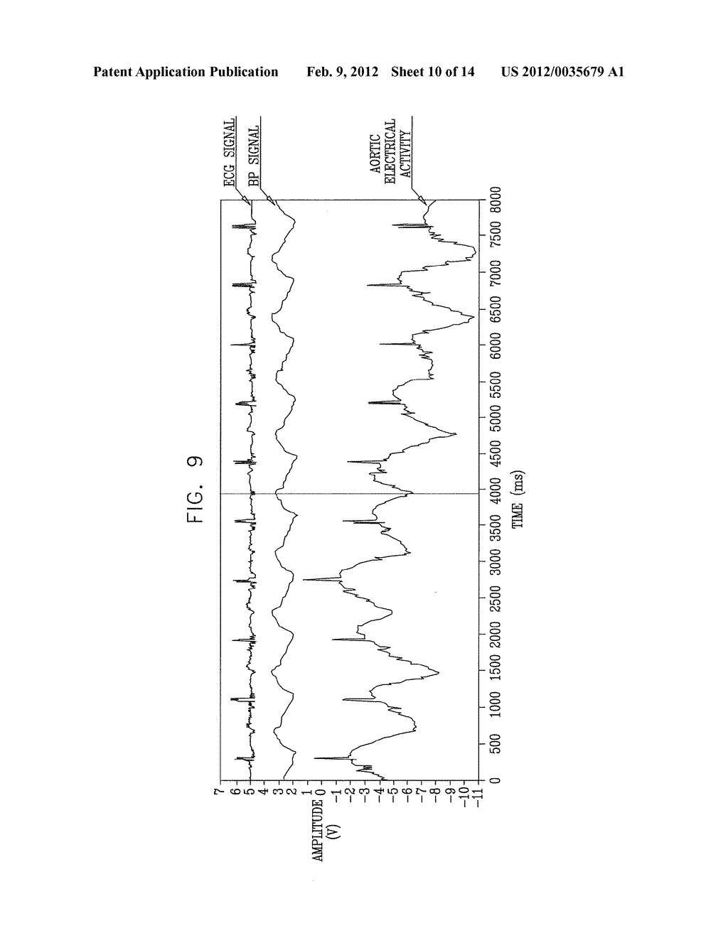 ACUTE MYOCARDIAL INFARCTION TREATMENT BY ELECTRICAL STIMULATION OF THE     THORACIC AORTA - diagram, schematic, and image 11