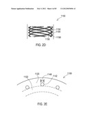 TERMINATION OF A SHIELD WITHIN AN IMPLANTABLE MEDICAL LEAD diagram and image