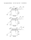 TERMINATION OF A SHIELD WITHIN AN IMPLANTABLE MEDICAL LEAD diagram and image