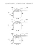 TERMINATION OF A SHIELD WITHIN AN IMPLANTABLE MEDICAL LEAD diagram and image