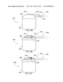 TERMINATION OF A SHIELD WITHIN AN IMPLANTABLE MEDICAL LEAD diagram and image