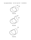 TERMINATION OF A SHIELD WITHIN AN IMPLANTABLE MEDICAL LEAD diagram and image