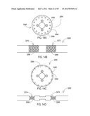 TERMINATION OF A SHIELD WITHIN AN IMPLANTABLE MEDICAL LEAD diagram and image