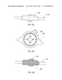 TERMINATION OF A SHIELD WITHIN AN IMPLANTABLE MEDICAL LEAD diagram and image