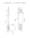 TERMINATION OF A SHIELD WITHIN AN IMPLANTABLE MEDICAL LEAD diagram and image