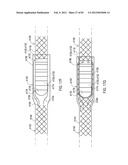 TERMINATION OF A SHIELD WITHIN AN IMPLANTABLE MEDICAL LEAD diagram and image