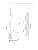 TERMINATION OF A SHIELD WITHIN AN IMPLANTABLE MEDICAL LEAD diagram and image