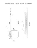 TERMINATION OF A SHIELD WITHIN AN IMPLANTABLE MEDICAL LEAD diagram and image