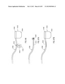 TERMINATION OF A SHIELD WITHIN AN IMPLANTABLE MEDICAL LEAD diagram and image