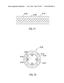 TERMINATION OF A SHIELD WITHIN AN IMPLANTABLE MEDICAL LEAD diagram and image