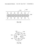 TERMINATION OF A SHIELD WITHIN AN IMPLANTABLE MEDICAL LEAD diagram and image