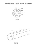 TERMINATION OF A SHIELD WITHIN AN IMPLANTABLE MEDICAL LEAD diagram and image