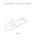 TERMINATION OF A SHIELD WITHIN AN IMPLANTABLE MEDICAL LEAD diagram and image