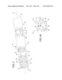 BLOOD PERFUSION DEVICE diagram and image