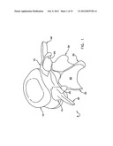 Prothesis For the Replacement of a Posterior Element of a Vertebra diagram and image