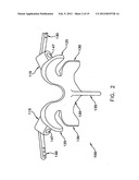 Prothesis For the Replacement of a Posterior Element of a Vertebra diagram and image