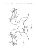 Prothesis For the Replacement of a Posterior Element of a Vertebra diagram and image