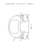 Prothesis For the Replacement of a Posterior Element of a Vertebra diagram and image